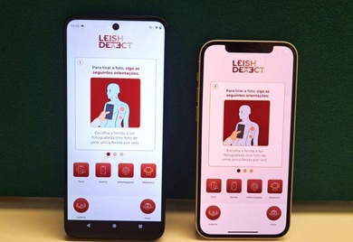 AI-based diagnostic model for Cutaneous Leishmaniasis capable of operating entirely offline