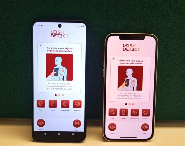 AI-based diagnostic model for Cutaneous Leishmaniasis capable of operating entirely offline