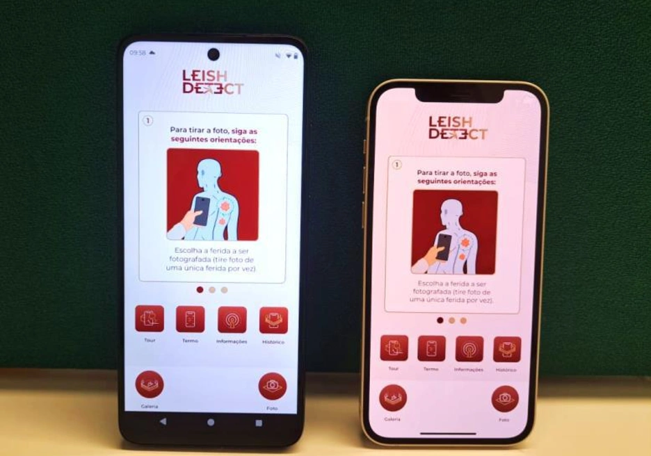 AI-based diagnostic model for Cutaneous Leishmaniasis capable of operating entirely offline